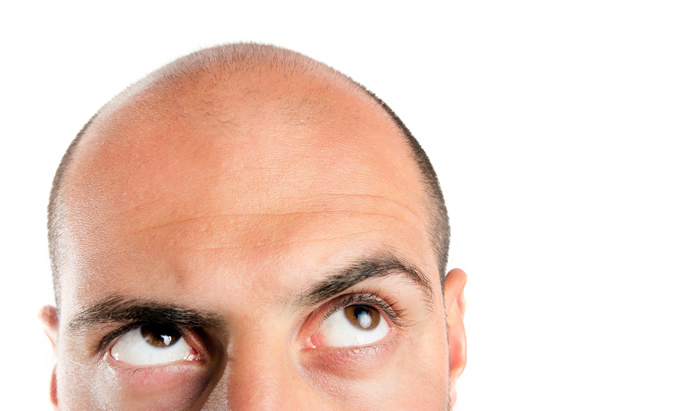 9 pasos para recuperar los foliculos pilosos dañados del cabello